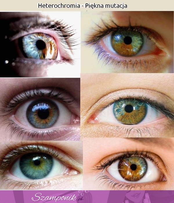 Heterochromia - mutacja, która powoduje, że ... ;) Wow! Robi wrażenie!